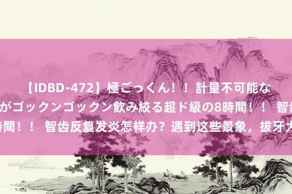 【IDBD-472】極ごっくん！！計量不可能な爆量ザーメンをS級女優がゴックンゴックン飲み絞る超ド級の8時間！！ 智齿反复发炎怎样办？遇到这些景象，拔牙大略是奢睿之选